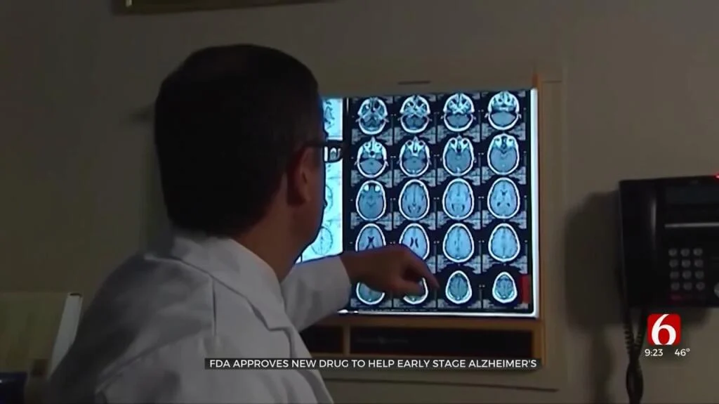 FDA Approves New Drug to Help Early-Stage Alzheimer’s Disease