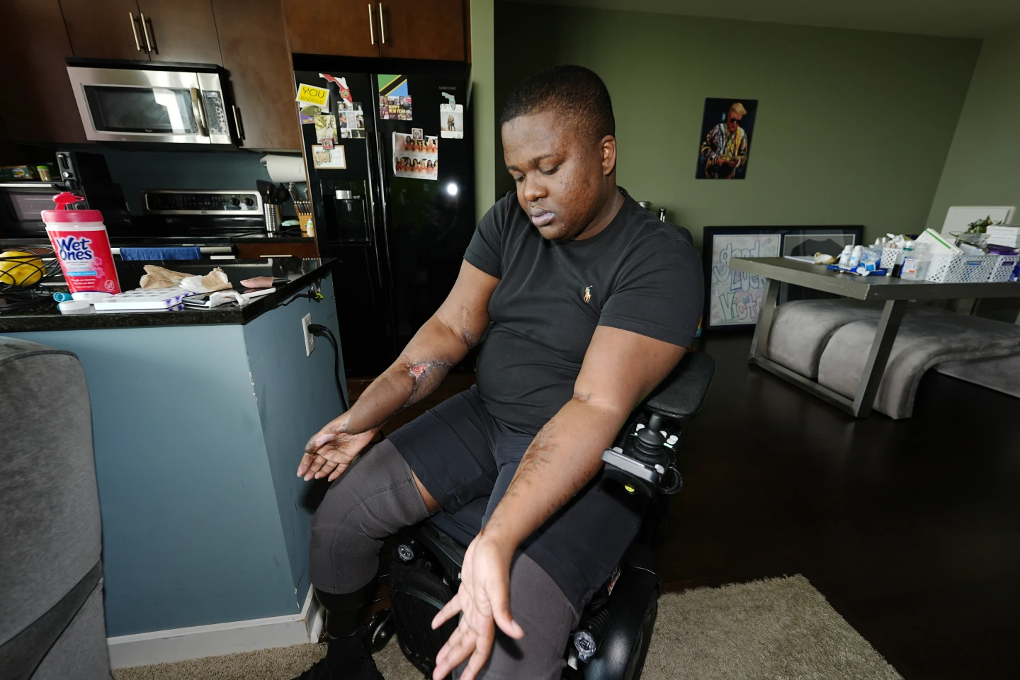 Police Recruit Who Lost Both Legs in ‘Barbaric Hazing Ritual’ Sues Denver, Paramedics and Officers